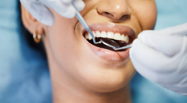 Best Emergency Dental Extractions in Wilder, ID